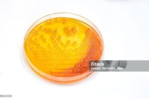 Microbial bioremediation 